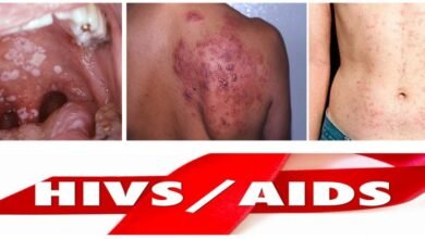 aids nasıl ortaya çıktı